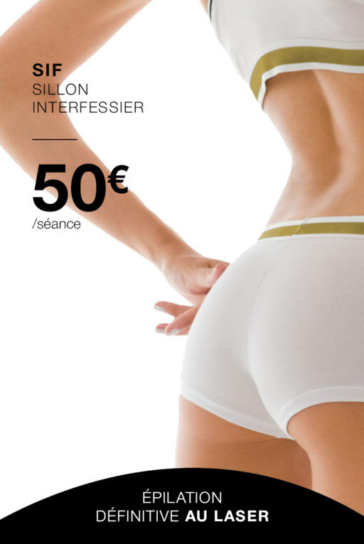 Épilation laser SIF Lille